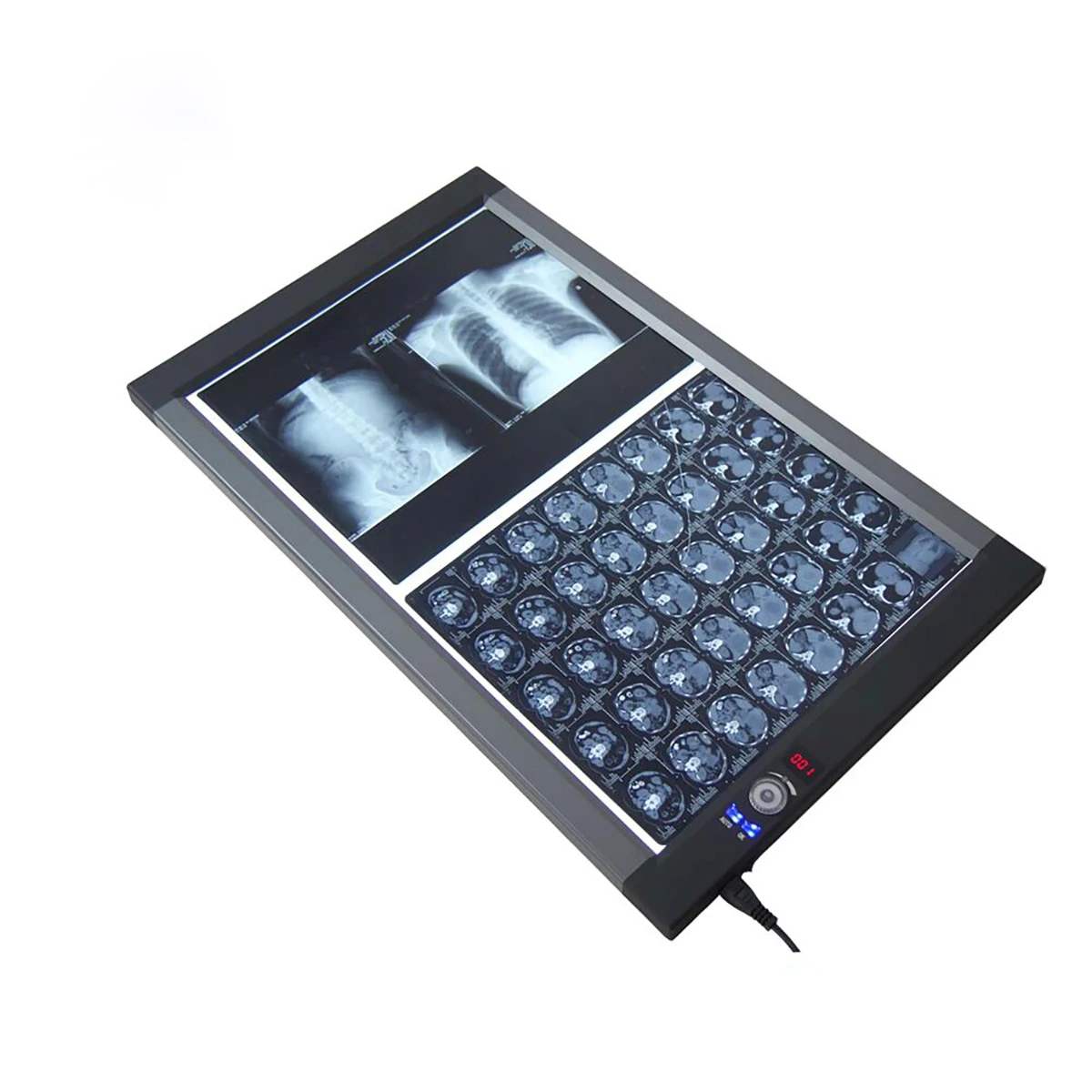 
Double Panel Medical LED X-ray Film Viewer X-ray Viewing Light MSLZG2C 