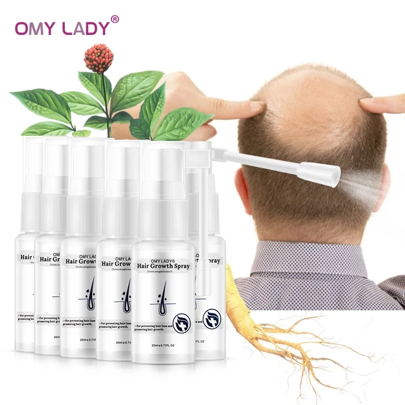 OMY LADY Hair Growth Spray Improve Prevent Hair Loss Products For Men Women
