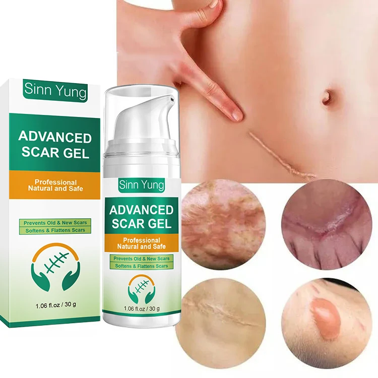 Sinn Yung Vegan Retinol Allantoin Effective Acne Skin Repair Advanced Silicone Scar Gel