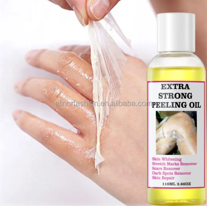 Best sale anti stretch marks multiple functions wholesale eternalelinor yellow peeling oil customized