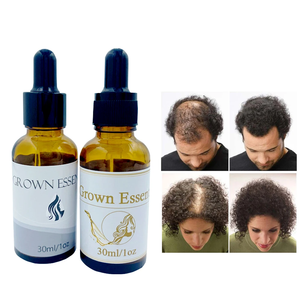 Private Label OEM Fast Organic Herbal Custom Men Care Anti Hair Loss Serum Fall Ginger Hair Growth Oil for Hair Regrowth