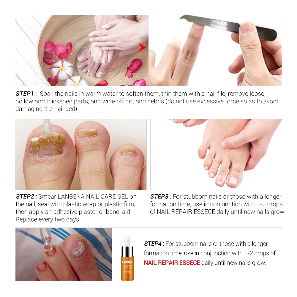 LANBENA Foot Nail Fungus Treatment Essence Nail Repair Gel Fungus Onychomycosis Treatment with Nail File gift
