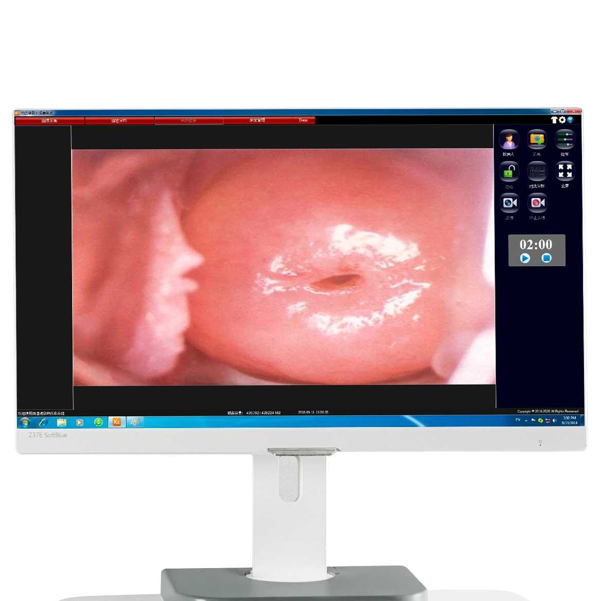 Kernel KN-2200BII 3D visual Optical binoculars digital video colposcope gynecology examination vagina colposcopy instrument