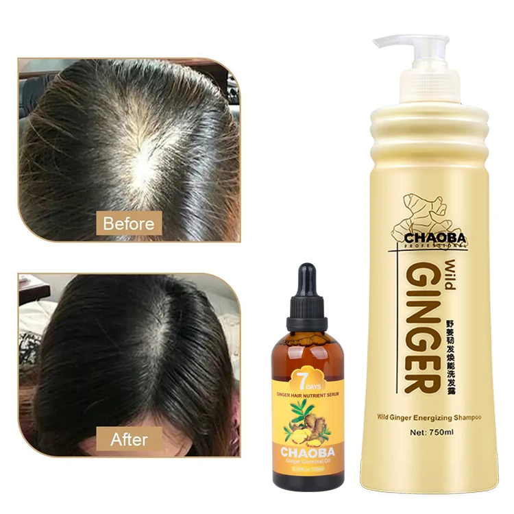 OEM Private Label Champoo Herbal Thickening Organic Hair Care Ginger Regrowth Ginseng Anti Hair Loss Fall Prevent Growth Shampoo