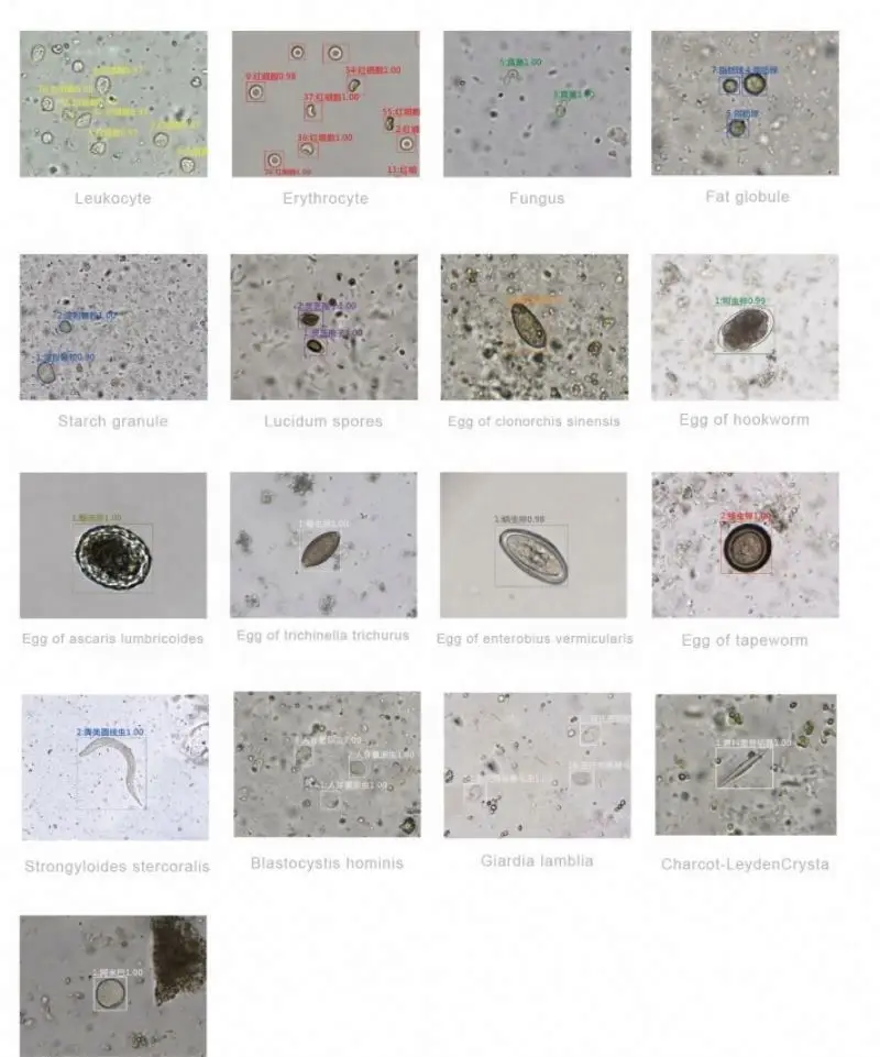 Двухканальный автоматизированный анализатор фекалий/анализы банки Фекалий