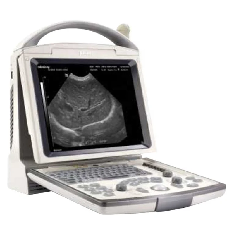 
Without battery 2 probe interface 12-inch screen Mindray DP-30 Fully Digital Portable Ultrasound Diagnosis System 
