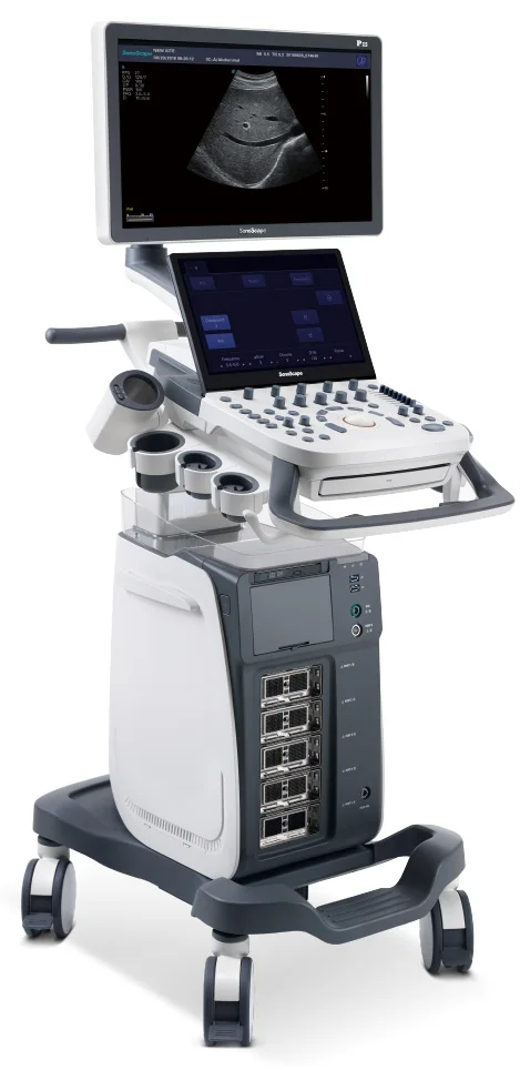  Sonoscape P15 4D/5D корзина цветной ультразвуковой 21 5 