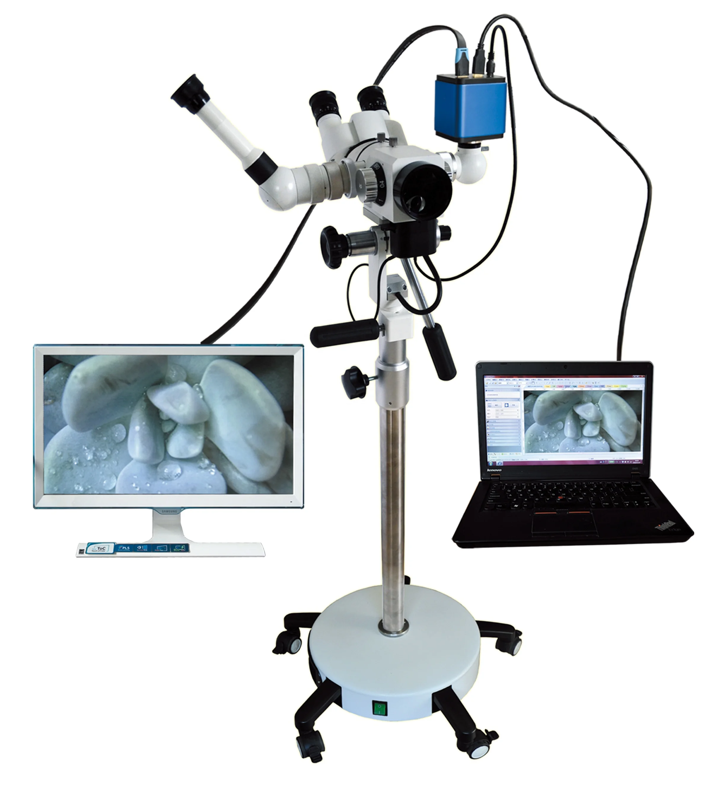 Лучший дешевый цифровой колпоскоп для гинекологии