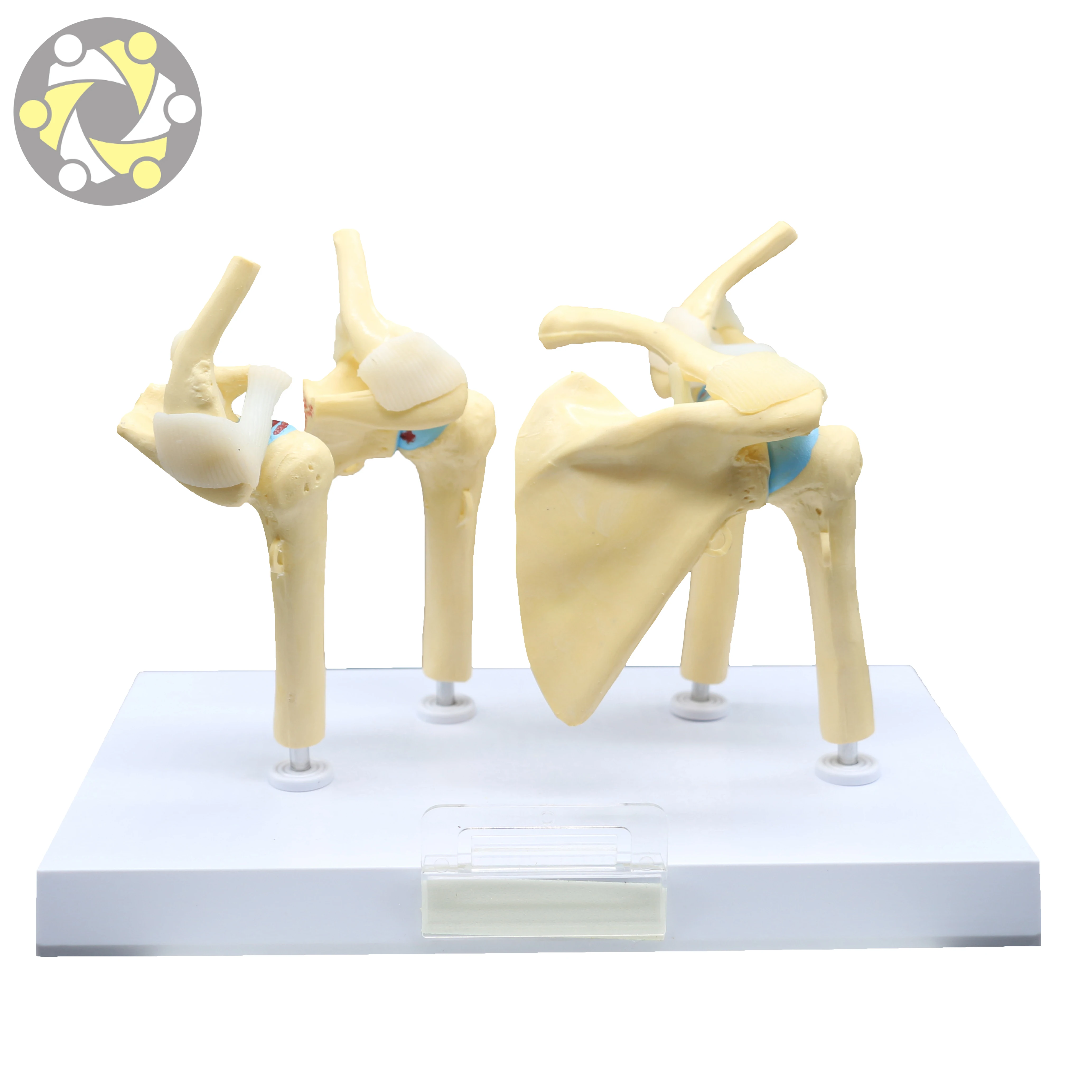 Medical Science Skeleton Model Human Diseased 4 Stage Osteoarthritic Shoulder Model for Teaching