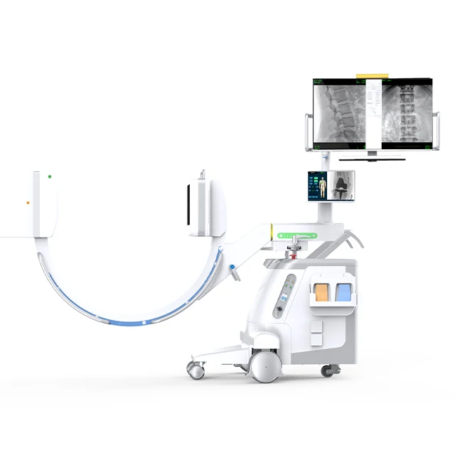 Professional Medical 5.6kw High Frequency Digital Fluoroscopy Mobile C arm X Ray Machine