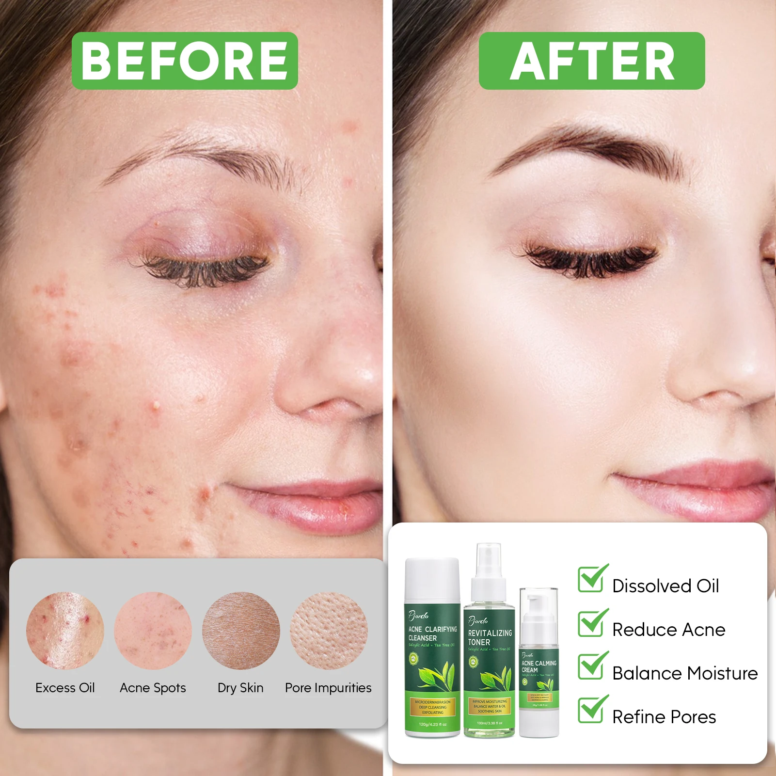 Pjordo Private Label Moisturizing Anti Redness Skin Soothing Tea Tree Acne Treatment Skincare Set 3PCS Tea Tree Skin Care Set