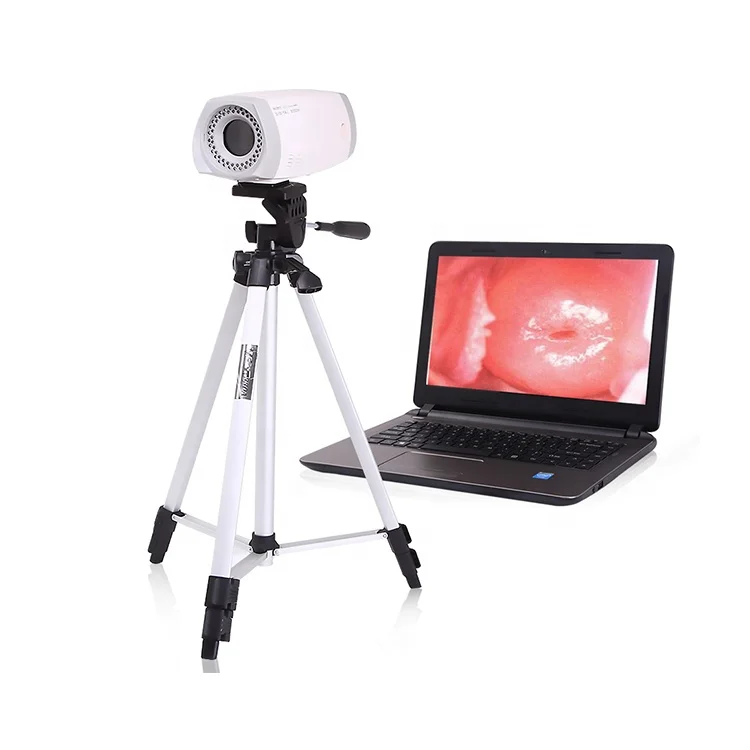 
Cheap Price Portable Vagina Colposcopy Digital Video Colposcope Camera Machine 