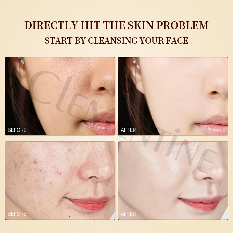 Private Label Vegan Moisturizing Whitening Face Wash Deep Cleaning Melting  Facial Cleansing Organic Facial Cleanser