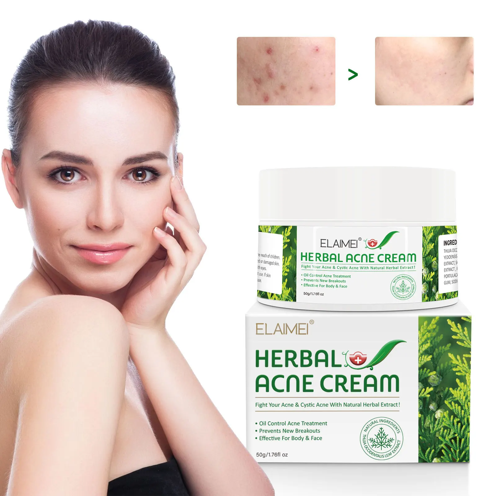 Private Label Natural Herbal Acne Repair Cream Beauty Effective For Face Body Oil Control Acne Treatment Cream