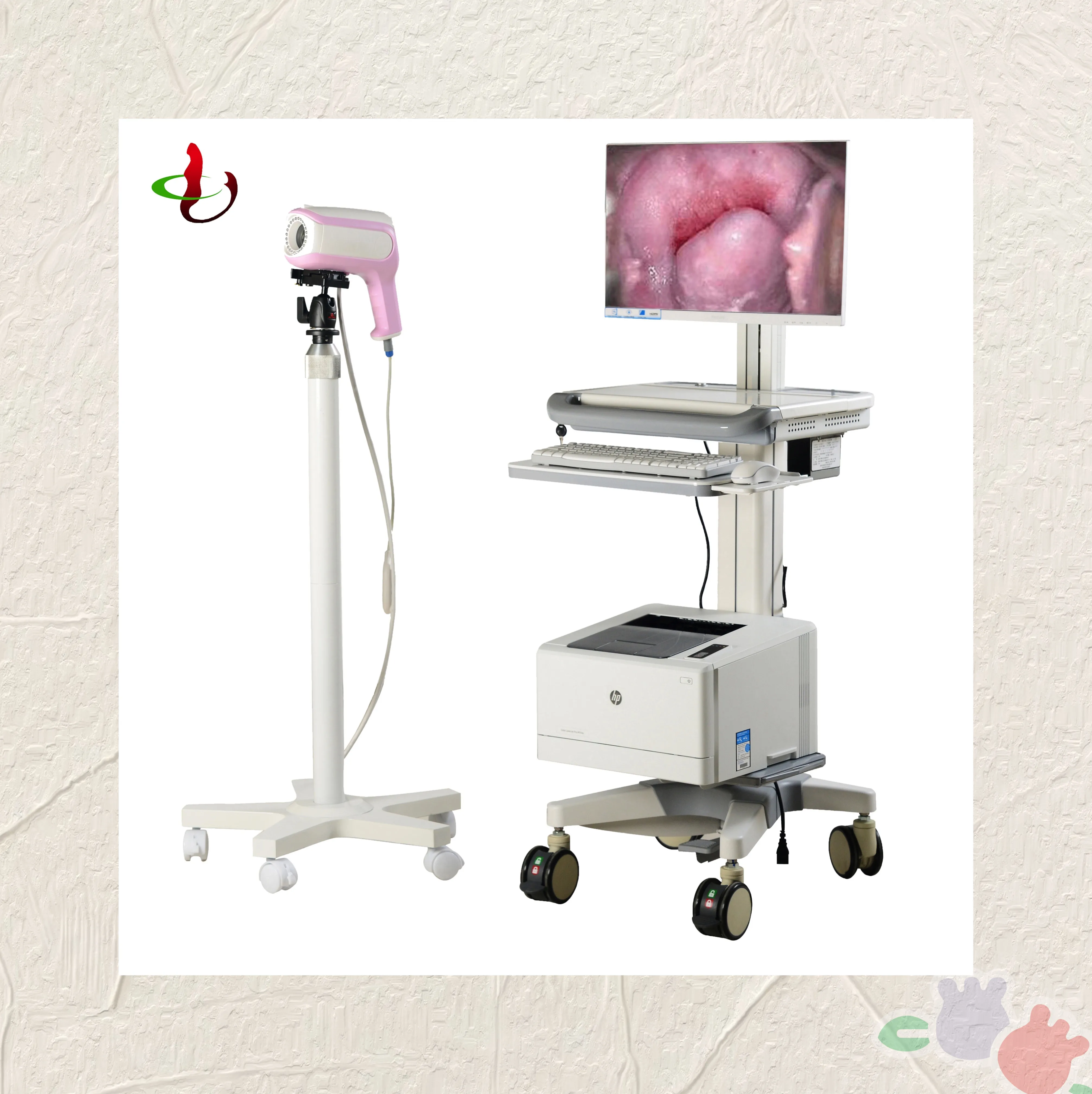 Hospital professional Medical System Specialized Digital Optical Colposcope