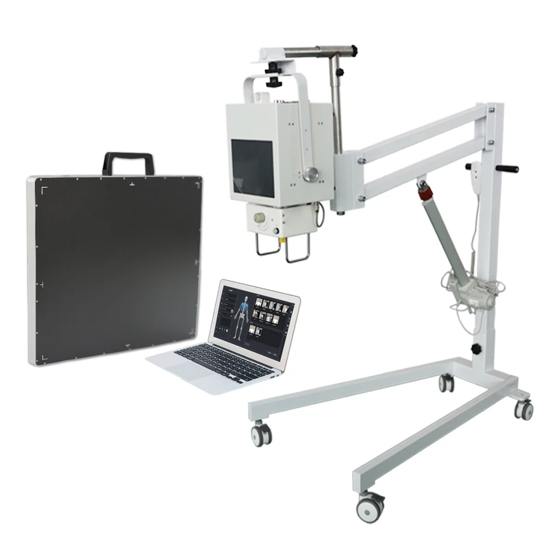portable x-ray machine price 5KW portable digital xray 100mA mobile x ray machine