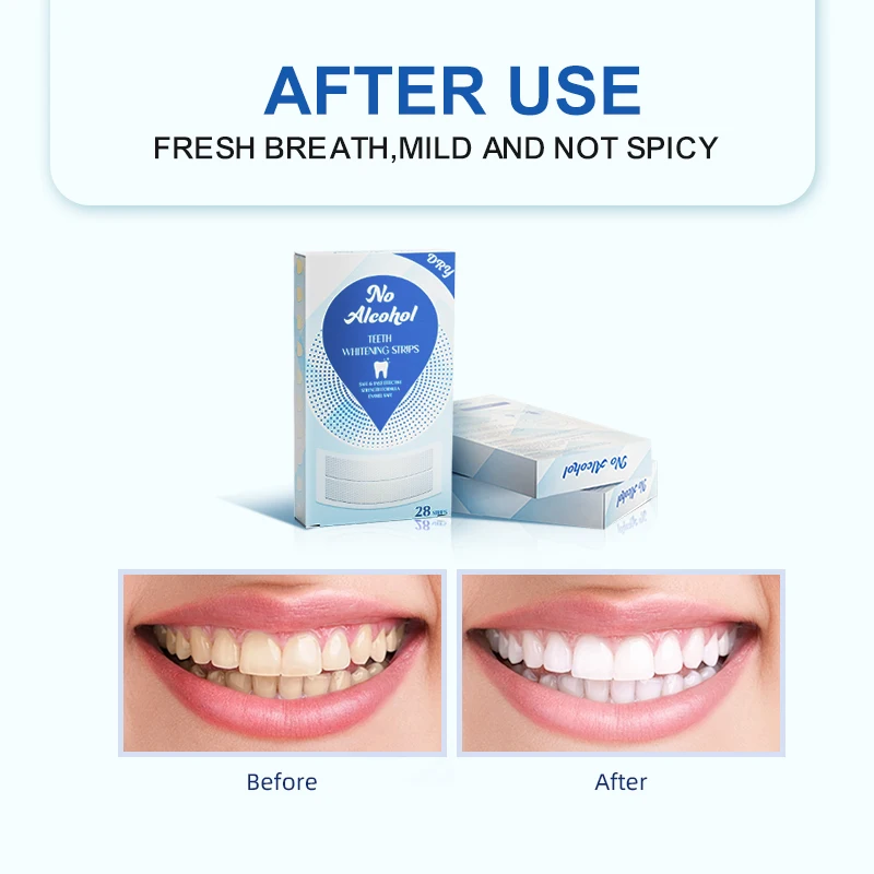 Best Result Tooth Bleaching Gel Strips Non Residue Home Teeth Whitening Strips Custom Logo