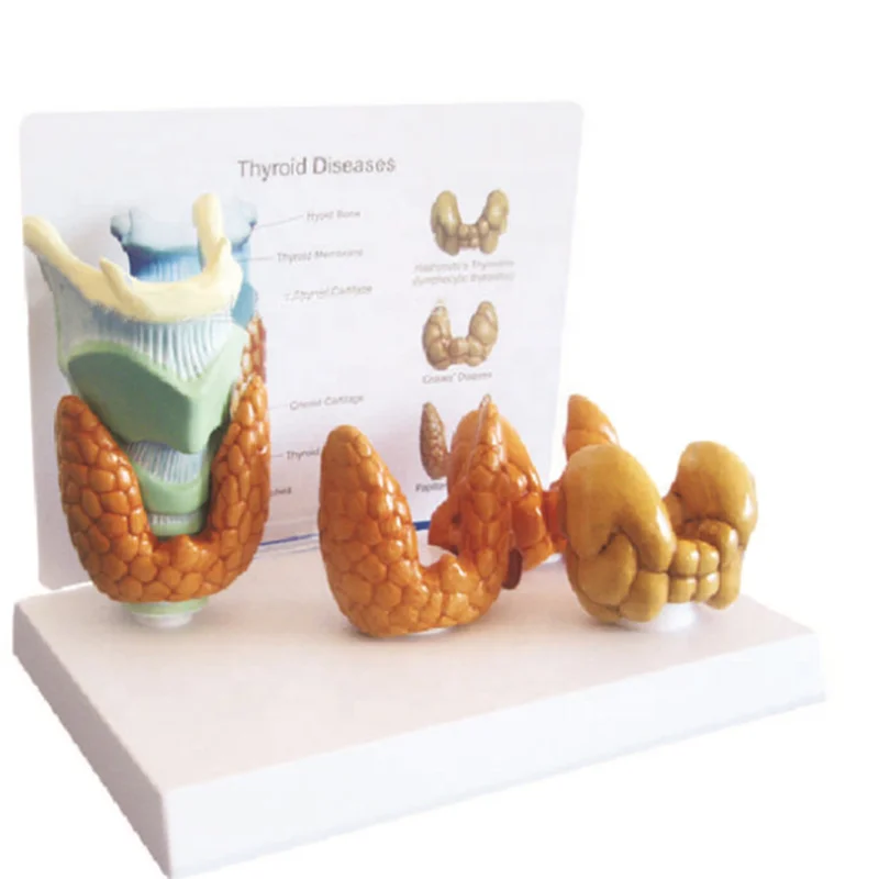 Human Anatomy  Laryngeal Pathology  Model  Thyroid Diseases Dimension Model