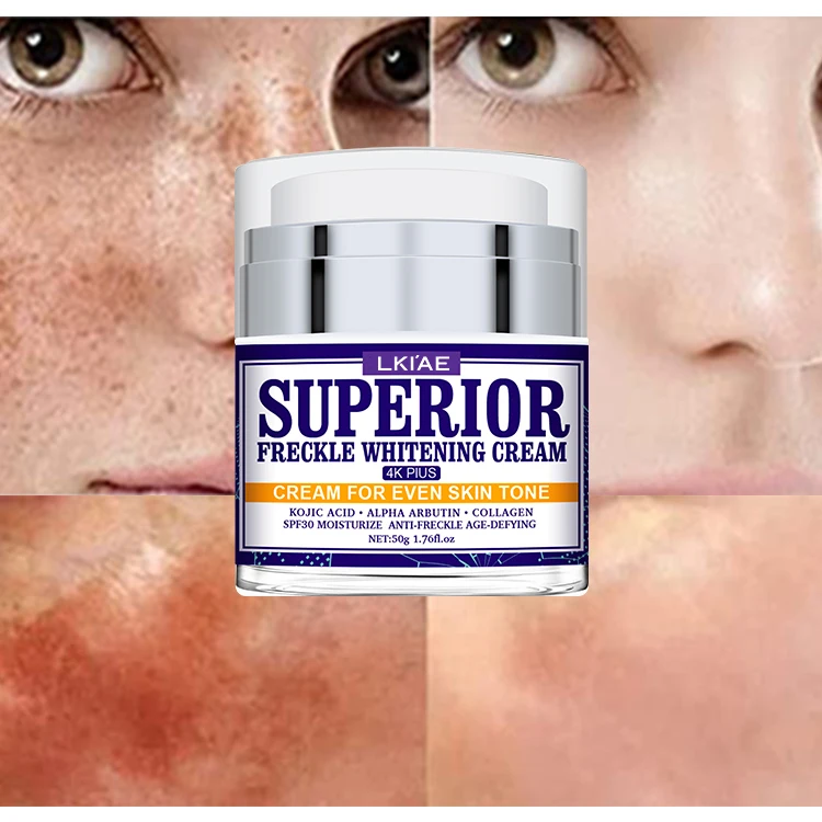 Private Label Skin Powerful Whitening Freckle Removal Face Bleaching Cream