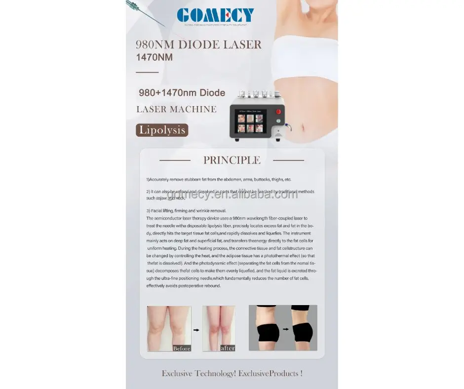 2024-Top-Sales-Most-Effective-Skin-Rejuvenation-Endolaser-Diode-Liposuction-Equipment-980-Nm-1470-