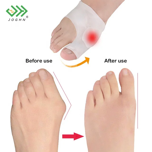 JOGHN Splitter Toe Separator Gel Foot Bunion Corrector Pedicure Sock Unisex Silicone Sebs Toe Separator Individual Silicon
