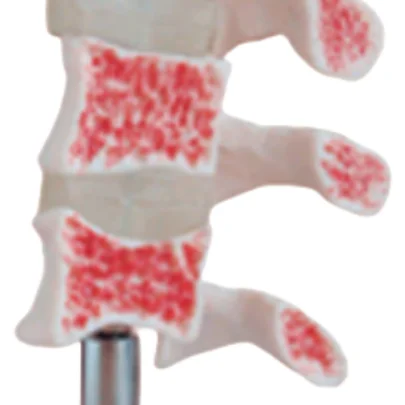 BIX-A1022 PVC Life-Size Human Anatomical Skeleton Osteoporosis Models for Medical School Training