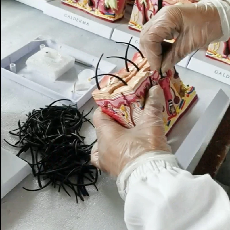 Medical science  biology  pathological skin acne anatomical  structure 3D diseased  model