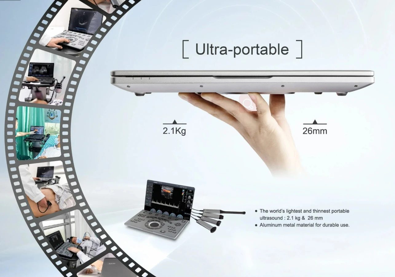 Chison Sonoair Portable machine color doppler ultrasound machine Medical Ultrasound system Scanner Sonoair70