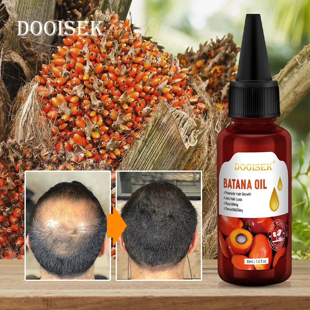 New Factory Pure Organic Batana Oil Repair Damaged Hair Promotes Strengthening Hair Growth Rosemary Hair Care Essential Oil