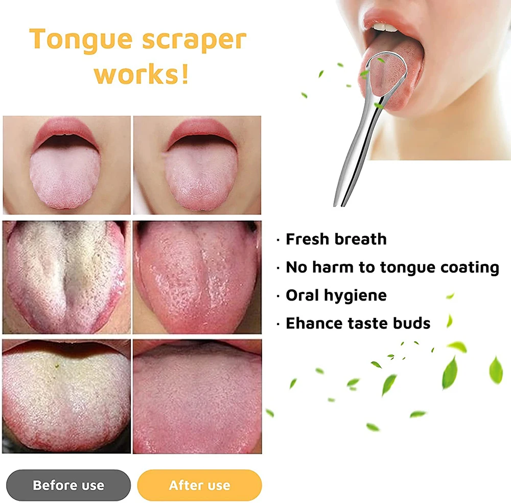 2 Pack Bad Breath Treatment 100% Stainless Steel Metal U Shaped Tongue Scraper for Travel Packing Box