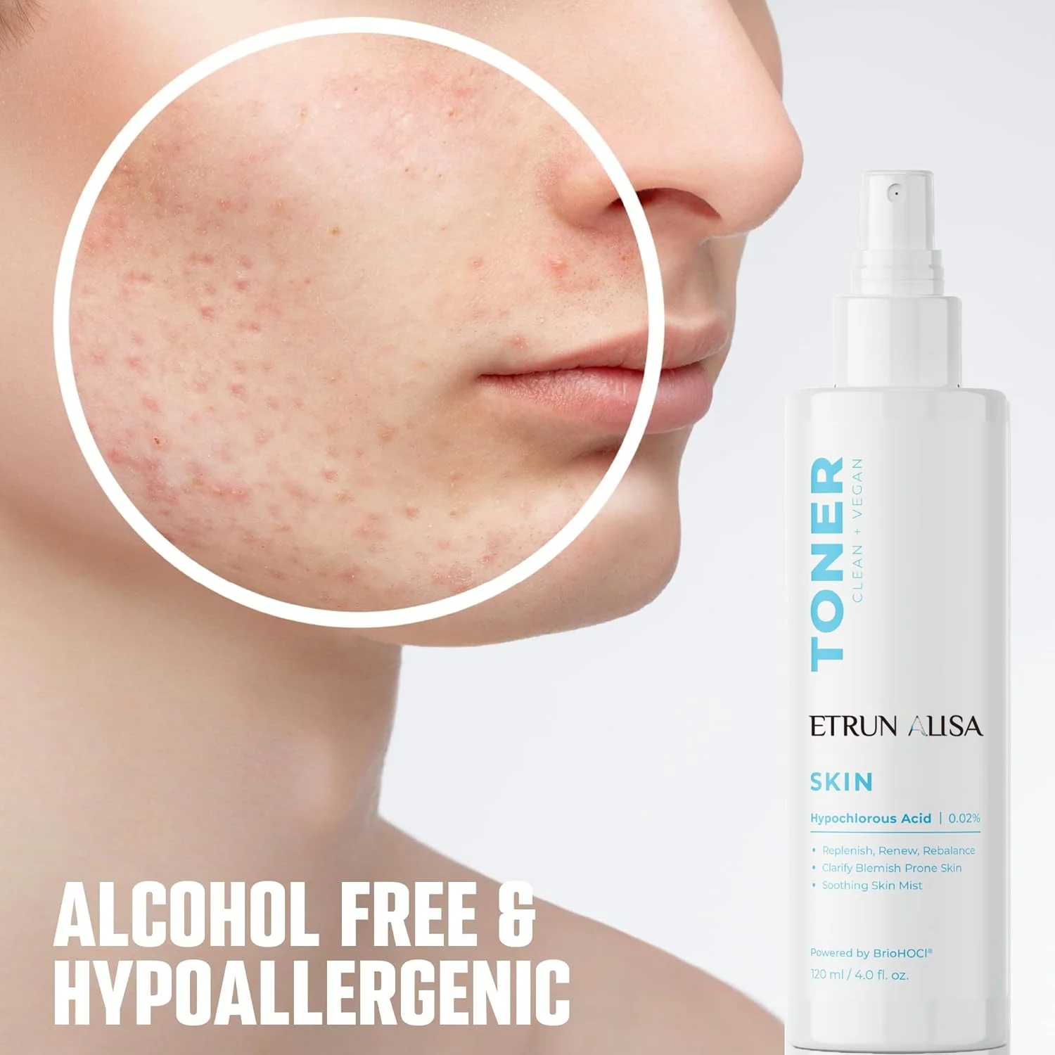 ETRUN ALISA private label Soothing and calming Mist hypochlorous acid face spray toner for eczema skin irritations redness