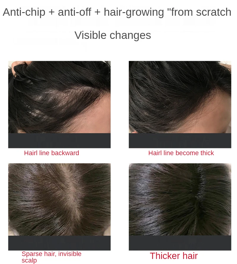 ODM/OEM Anti-off Hair Renewal Liquid Scalp Massage Hair Follicle Repair Firming Grow Fluid Generation Prevent Hair Loss Shampoo