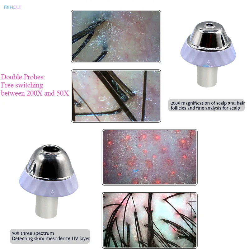hd hair follicles scalp scanner 2 in 1 hair and skin scanner