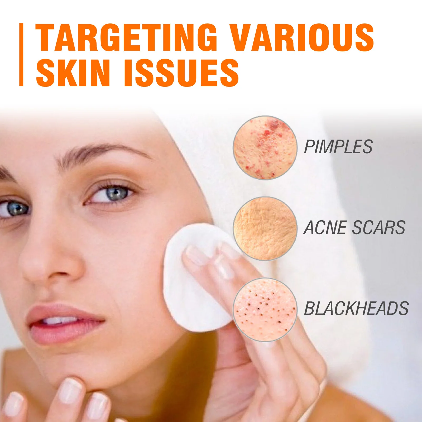 Hot Selling Acne Removal Cream Herbal Acne Spots Oil Control Acne Cream Spot Pimples Remove BHA Salicylic Acid Facial Cream