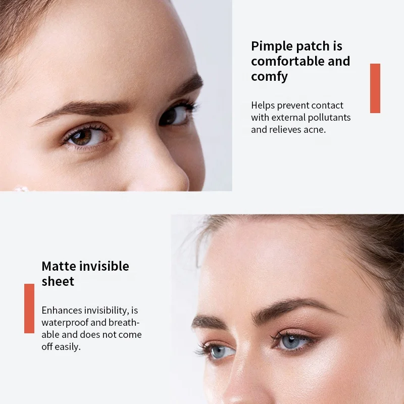 Skincare Manufacturer Invisible Hydrocolloid Acne Patches OEM Logo Korea Acne Patch Custom Large Circle Small Circle Acne Patch