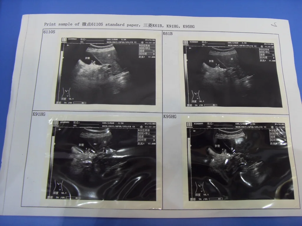 P93C Black and White Ultrasound Thermal  video printer