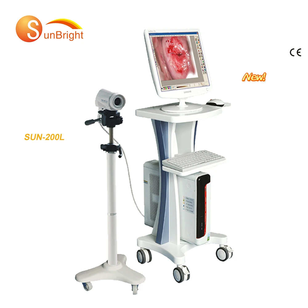 Cheap Price full set Vagina Colposcopy Digital Video Colposcope Camera Machine Gynecology Used for Sale