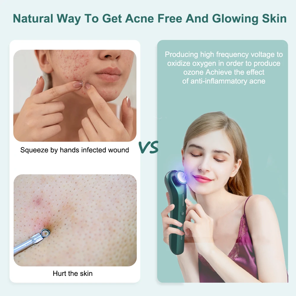 Home Use Skin Ionic Beauty Instrument Most Popular Sanitization Ionic Pen Acne Treatment Beauty Apparatus