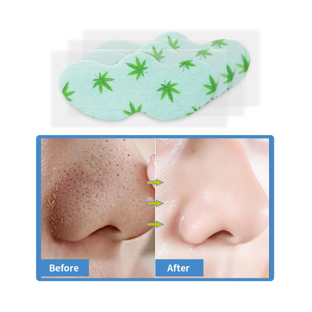Plants Pore Strips Ointment Peeling Type To Remove Blackheads And Acne Nose Mask Beauty Skin Care