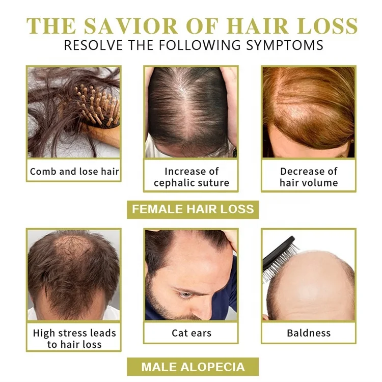 Private Label Rice Wheat Germ Bald Alopecia Hair Growth Regrowth Oil For Hair Treatment