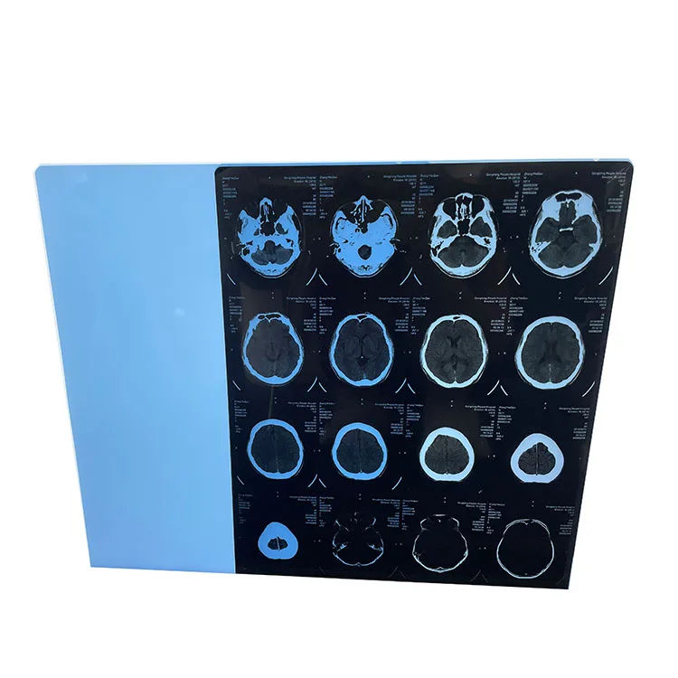 Medical Dry Film for Fuji printer X Ray Dry Film