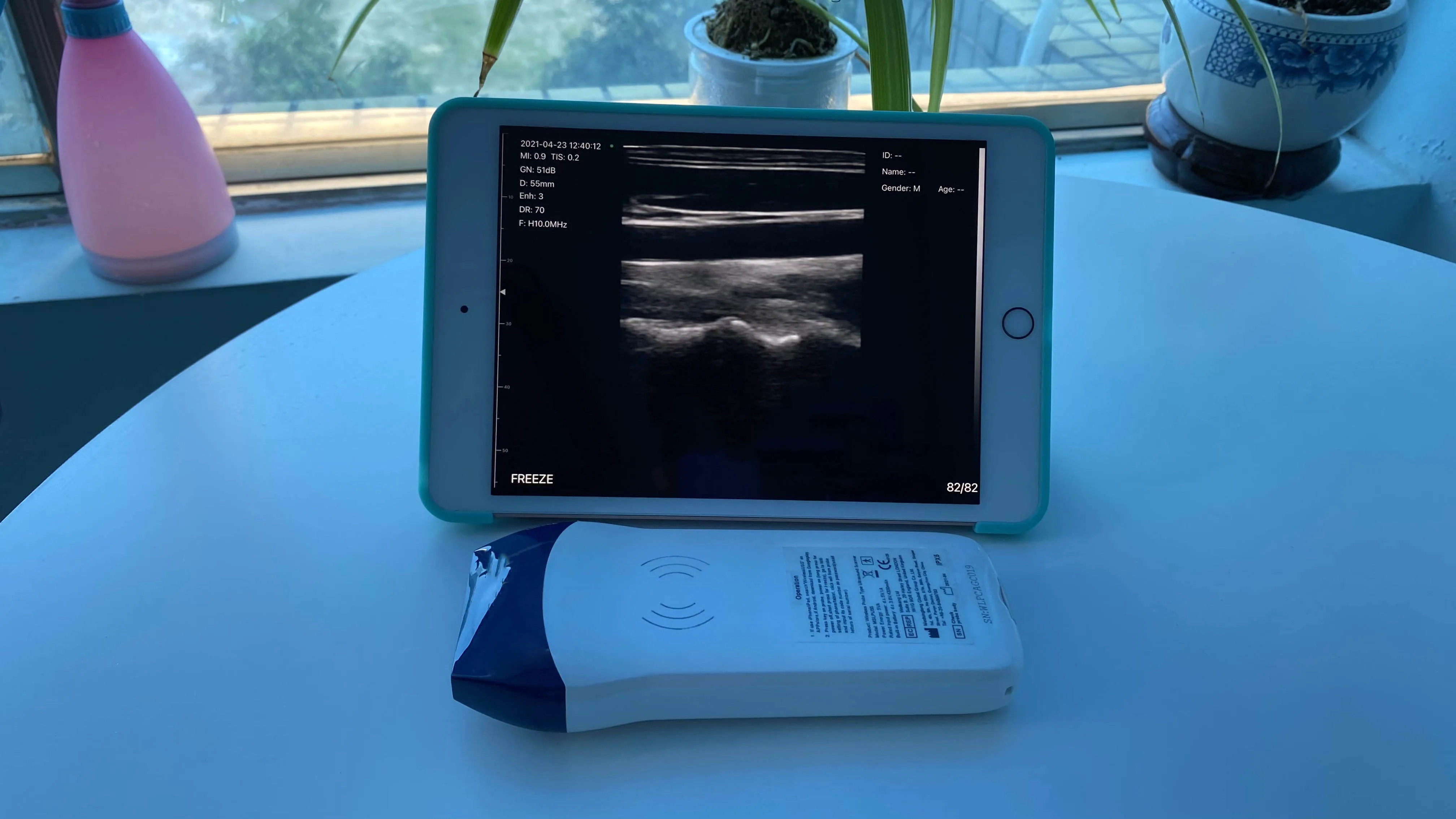 High Quality Wifi Linear Ultrasound Probe  Color Doppler Version Linear Wireless Probe MSLPU55