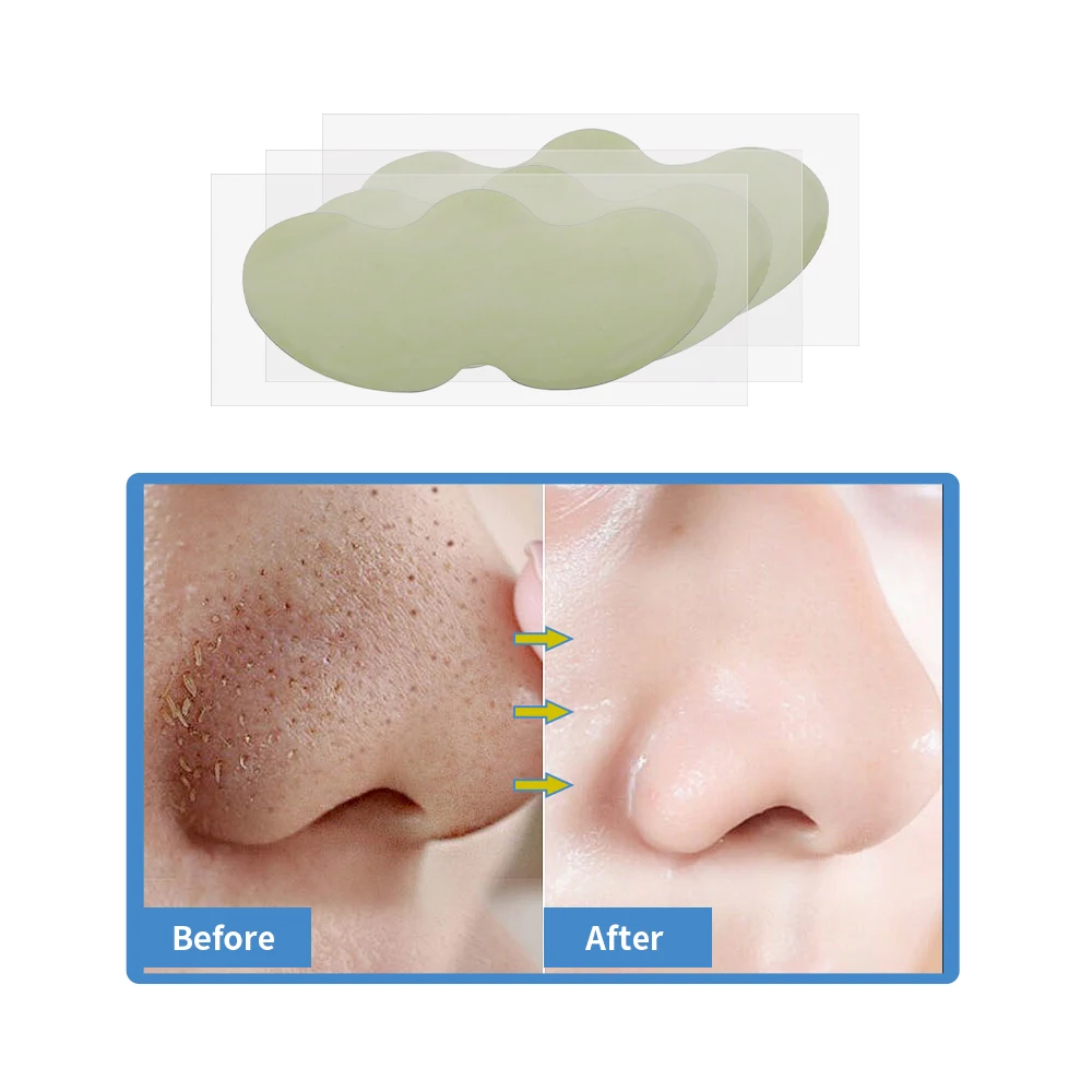 OEM Nose Strips Blackhead Removal Peel Off Mask Plants Pore Nose Patch Strips For Blackhead