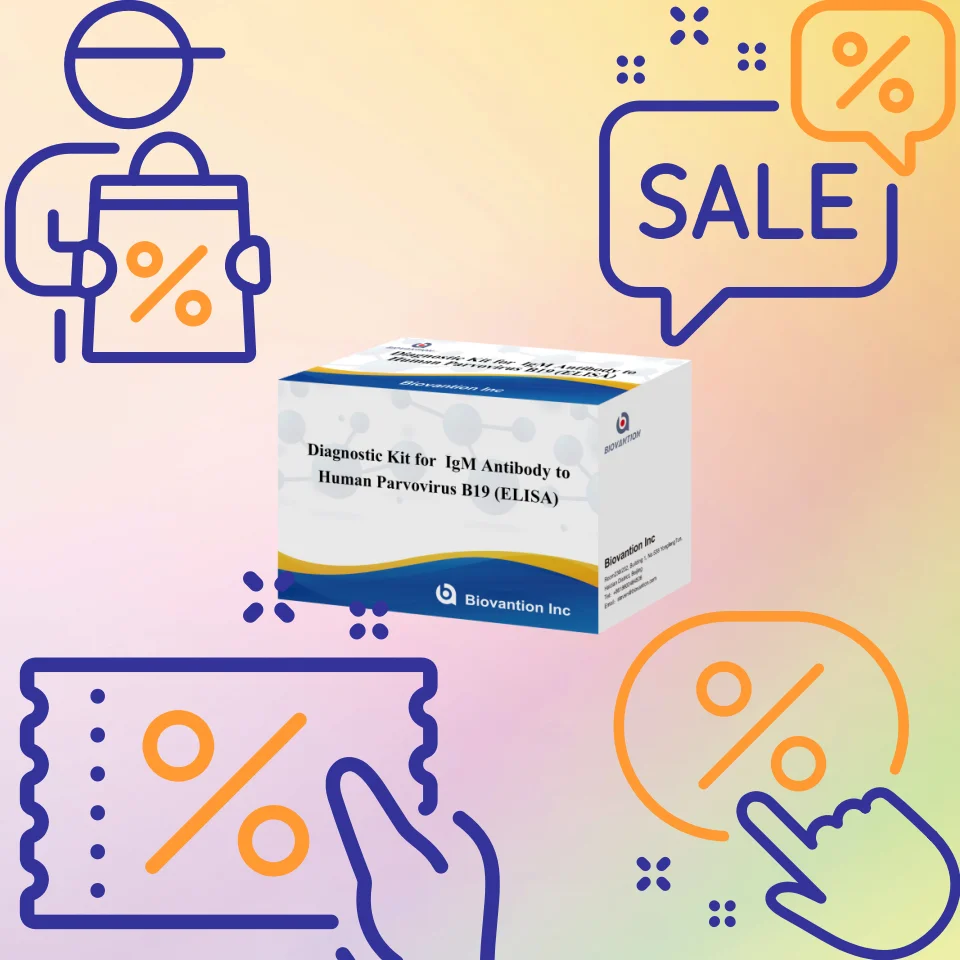 Elisa Diagnostic Kit for Human Parvovirus B19 IgM Antibody for hospital and lab