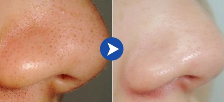 Goat Milk Skin Whitening and Bleaching Body
