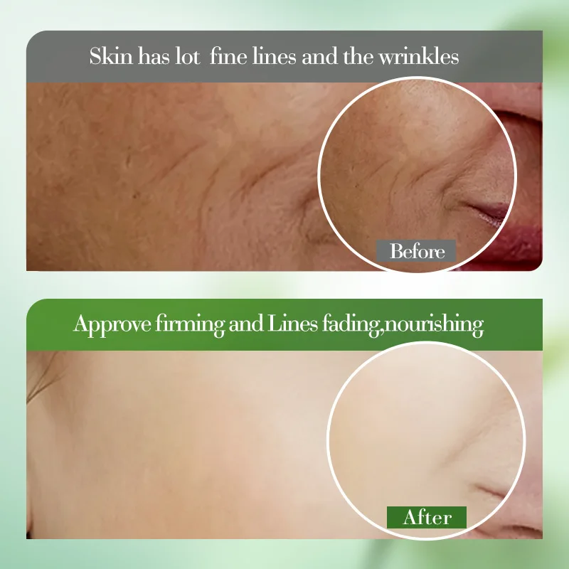 Whitening moisturizing anti wrinkle soothing and moisturizing skin moisturizing cream aloe face cream