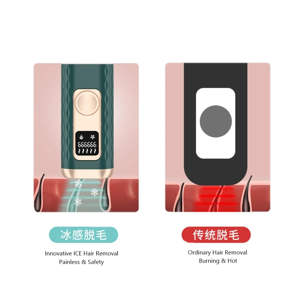 ice ipl hair removal 2 (4)