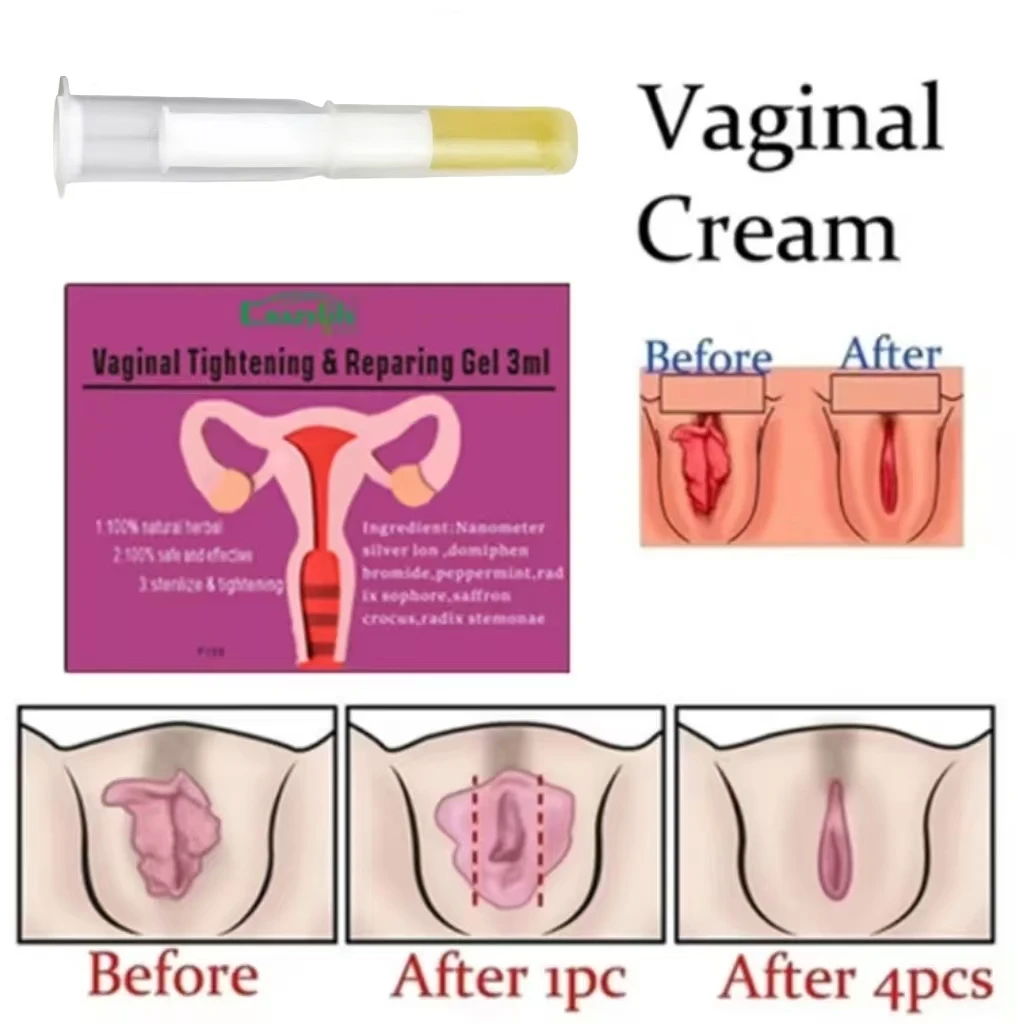 Personal Care Micro Ecological Feminine Balance Care gel antibacterial repair antibacterial gel