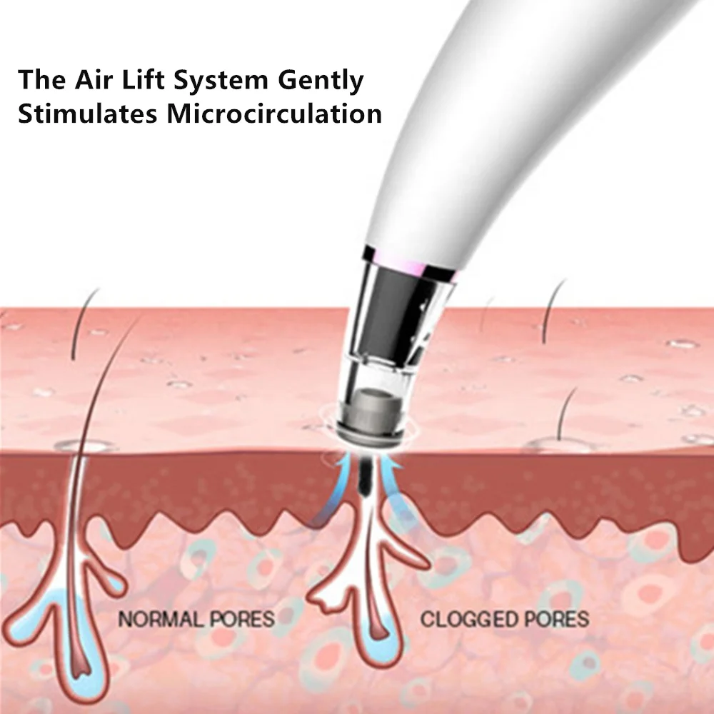  Машинка для микродермабразии устройство алмазного пилинга удаления черных точек алмазной дермабразии массажер лица