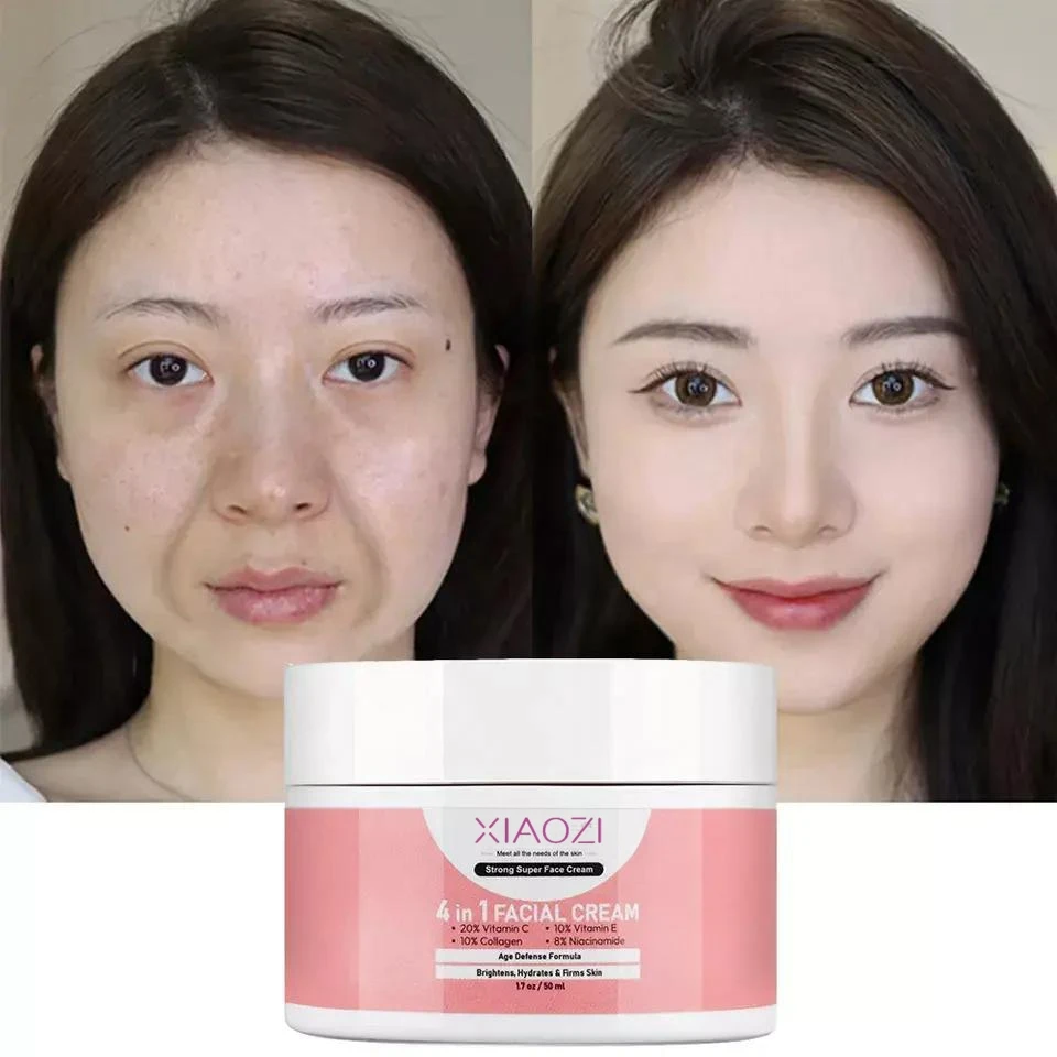 Strong Effective Skin Lightening Reduce Redness Burn Face Face Whitening Freckle Cream Remove Fade Dark Cream